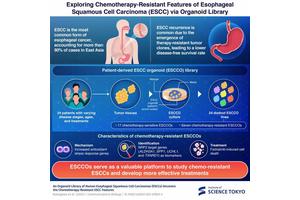 Lab-Grown Mini Tumors Pave the Way for Breakthroughs in Esophageal Cancer Treatment