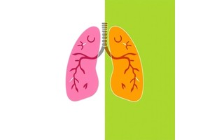 Combining Corticosteroids: Weighing Lung Benefits, Brain Risks