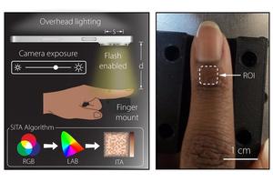 Smartphones Enhance Medical Device Accuracy Across Diverse Skin Tones