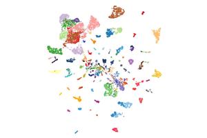 AI Model Identifies Over 170 Cancer Types, Revolutionizing Tumor Diagnostics