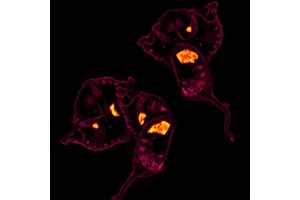 CYPD Restricts HR+ Breast Cancer in Mice