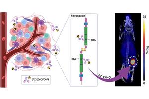 Innovative Imaging Technique Identifies Multiple Subtypes of Triple Negative Breast Cancer