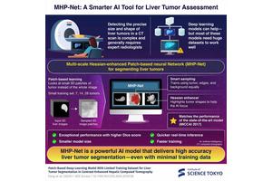 Introducing MHP-Net: A Groundbreaking AI Model Enhancing Liver Tumor Segmentation for Improved Diagnosis and Treatment