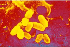 Heightened Vigilance and Targeted Public Health Strategies Crucial Amid Ongoing Diphtheria Epidemic Impacting Vulnerable Groups in Western Europe Since 2022