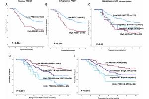 Inhibiting PRDX1 Protein Could Enhance Chemotherapy Effectiveness in Ovarian Cancer