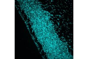 Harnessing Light to Control Bacteria: Advancing Beyond Antibiotic Resistance to Creating “Bacterial Robots”