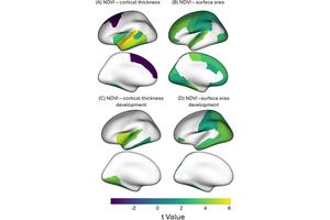 New Study Highlights How Greenspace Exposure Boosts Brain Development in Early Adolescence