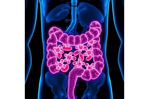 Colon Cancer Growth Linked to Lower Neoantigens, IFN-γ