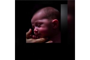 Predicting Outcomes of Late-Onset Sepsis in Premature Infants