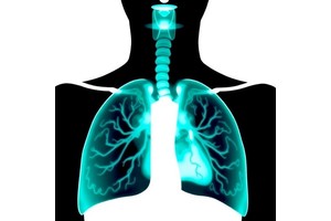 EIT Tracks Lung Recruitment in Preterm Infants