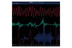 ECoG Reveals Syntax Encoding and Timing Dynamics