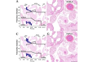 ACSL4, GPX4, FSP1 in Oxalate Kidney Injury