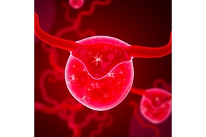 CEBPB Drives Endometrial Hyperplasia to Cancer