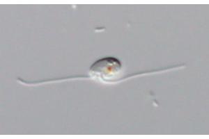 Rediscovering the Protist Glissandra: Unveiling Shared Traits of the Mysterious Crums Lineage