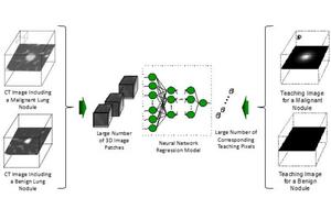 Cancer Diagnosis Now Possible on Your Laptop Thanks to New AI Model!