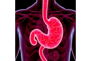 Chemo plus PD-1 and Bevacizumab Boost Gastric Cancer Therapy