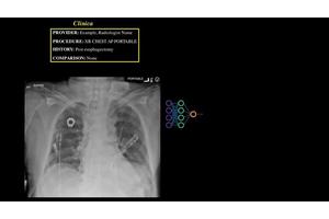 Revolutionary AI Enhances Radiology with Unprecedented Speed and Precision