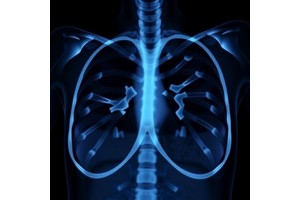 NRG Oncology Study Finds Regional Nodal Irradiation Does Not Lower Invasive Breast Cancer Recurrence in Patients with Axillary Node Conversion After Neoadjuvant Chemotherapy