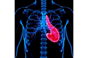 New Surgery-Chemotherapy Trial Targets Thymic Tumors