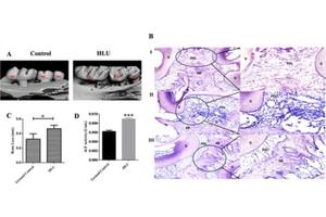 Scientists Reveal: Space Environment Linked to Gum Inflammation and Bone Loss