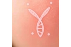 Genetic Inheritance Linked to Immunotherapy Resistance in Aggressive Skin Cancer