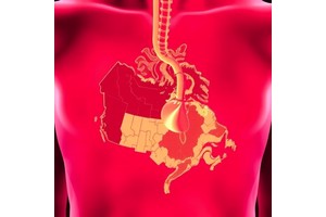 Cancer Risk in Quebec Organ Transplant Recipients